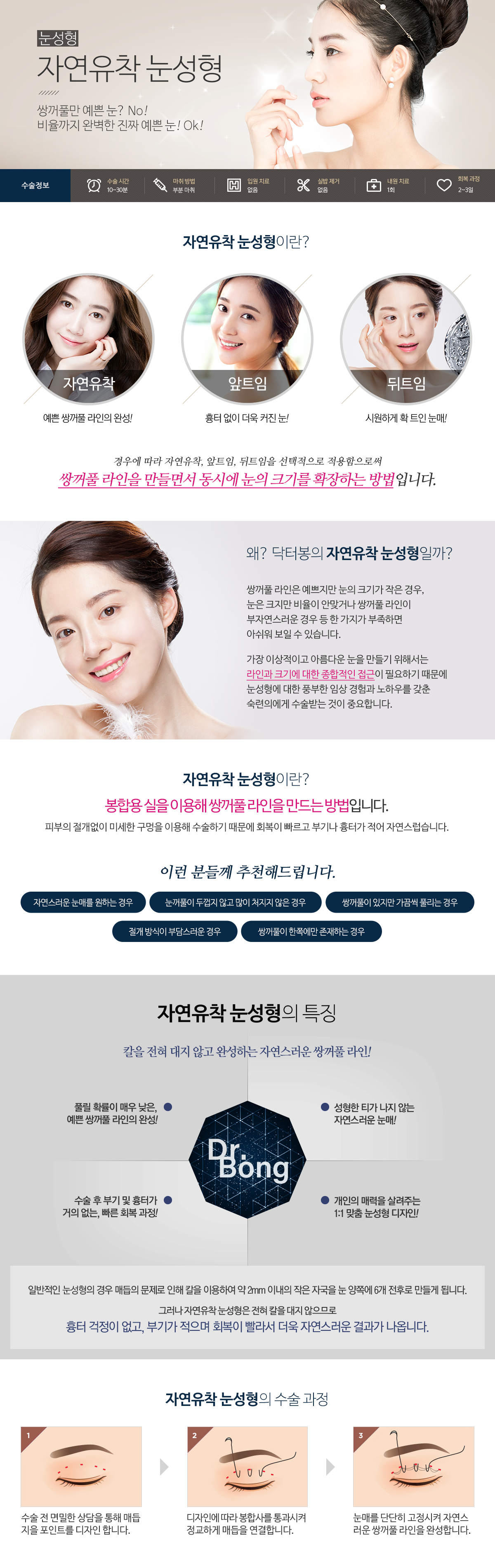 상안검