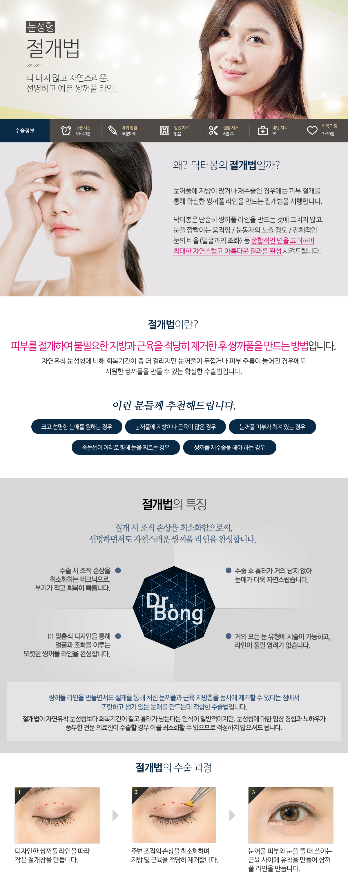 상안검