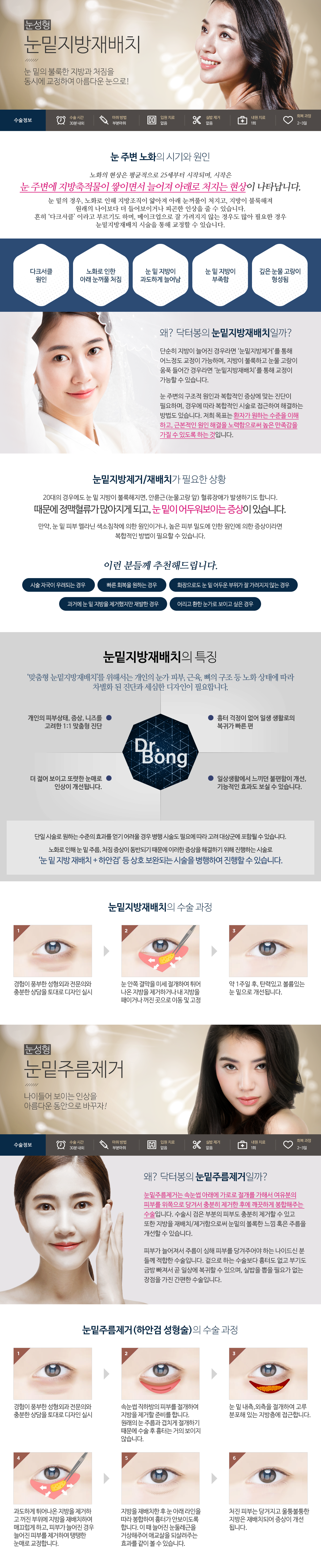 하안검